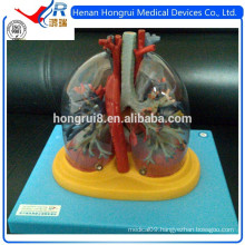 ISO Transparent lungs, trachea, bronchial tree with heart model